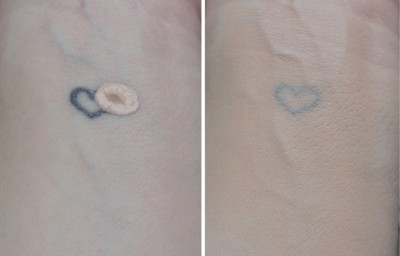 clinique beyound perfecting foundation + concealer swatches